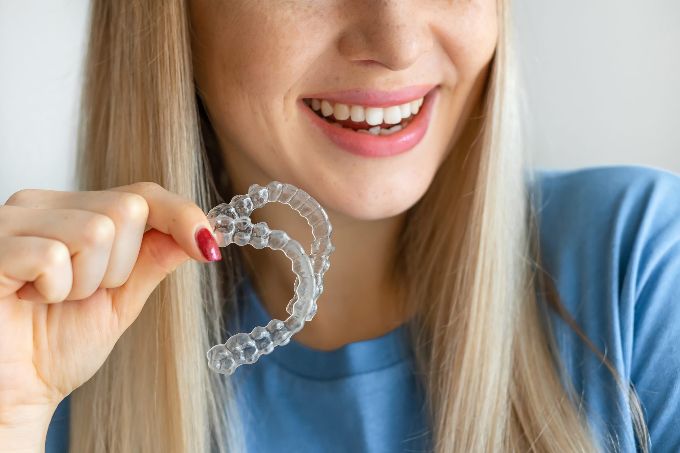 Clear Aligners for Your 30s, 40s, and Beyond